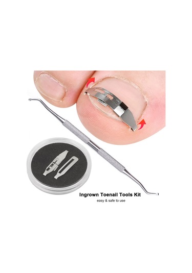 Qingmipy Tırnak Batması Düzeltici Seti - 2 Adet Takılabilir Aparat + Medikal Bant + Tırnak Kaldırıcı