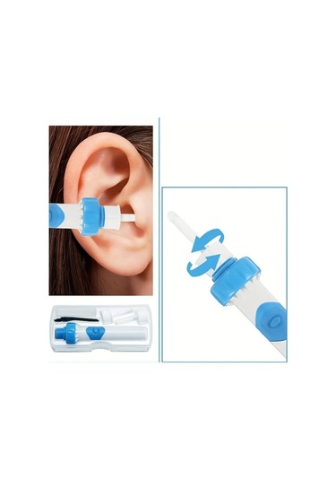 Elmpaly Beyaz Kulak Kirı Temizleme Seti Elektrikli Vakum Kulak Temizleyici Taşınabilir