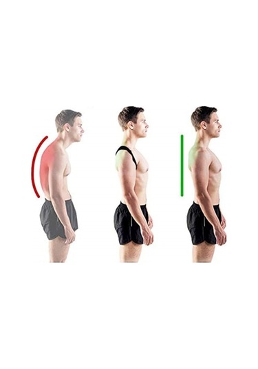 Medikal Deri Desenli Korse Ortopedik Dik Duruş Korsesi Kamburluk Korsesi