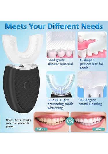 Yetişkinler İçin U Şeklinde Elektrikli Ultrasonik Diş Fırçası, Tüm Ağzı Temizlemek İçin 360 Otomatik Diş Fırçasıwhite