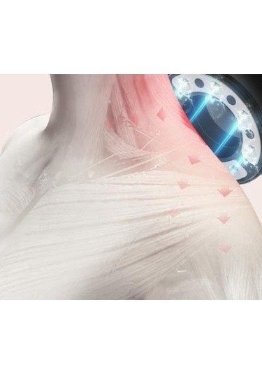 Wondernest Sıcak Lichen Kazıma Elektrikli Darbe Çukuru Aleti, Akıllı Kontrol Çok Renkli