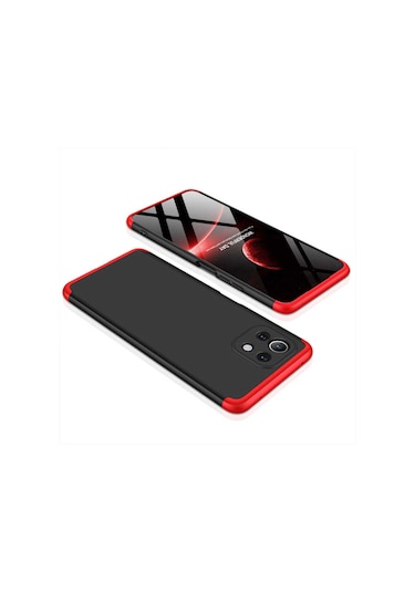Xiaomi Mi 11 Lite Kılıf Zore Ays Full Koruma Kılıf