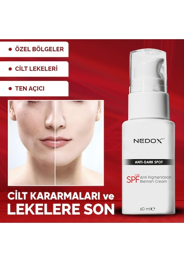 Nedox Cilt Beyazlatıcı Leke Kremi 60 ML