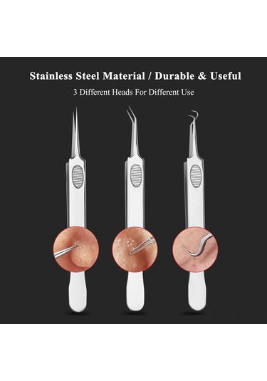 Vkemall 3'lü Paslanmaz Çelik Siyah Nokta Ve Sivilce Temizleme Seti - Cilt Bakımı Ve Hijyen İçin Profesyonel Araçlar