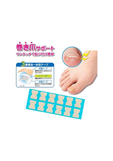 Suntek 1 Set Batık Ayak Tırnağı Düzeltici 72-yaprak