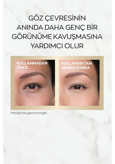 Avon Anew Renewal Power Göz Çevresi Kremi 15 ML