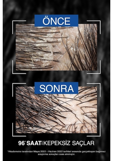 Bioblas Thermal Expert Men Kepeğe Karşı Şampuan 360 ml