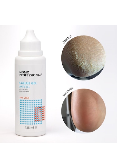 Callus Gel, Nasır Sökücü Keratolitik Pedikür Jel, 125 Ml