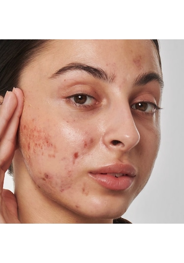 The Inkey List Scar Mark And Wrinkle Solution With 1% Retinol Serum 30 ML