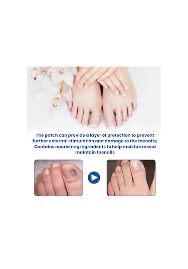 Geekyou 32 Adet Tırnak Mantar İyileştirici Yama - Glyserin Ve Çay Ağacı Yağı İçeren Tırnak Onarım Bandı