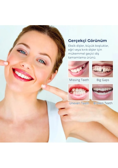 Soulbyee Geçici Diş Onarım Kiti 30 G