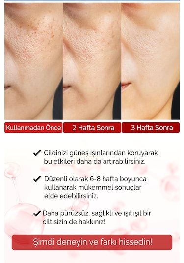 Kolajen + Nemlendirici Serum 2 Li Set  Alın Çizgisi Göz Çevresi