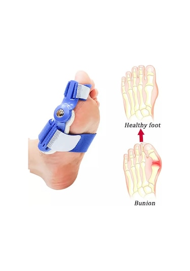 Ayak Baş Parmak Parmağı Kemik Kemiği Çıkıntısı Için Aparat Set