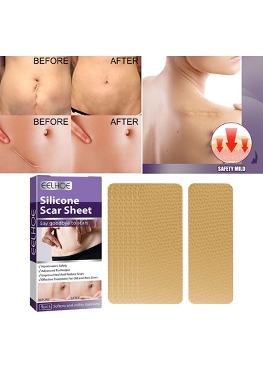 Dolıty Yanık İzleri Skar Yaması Çok Kullanımlı Yumuşak