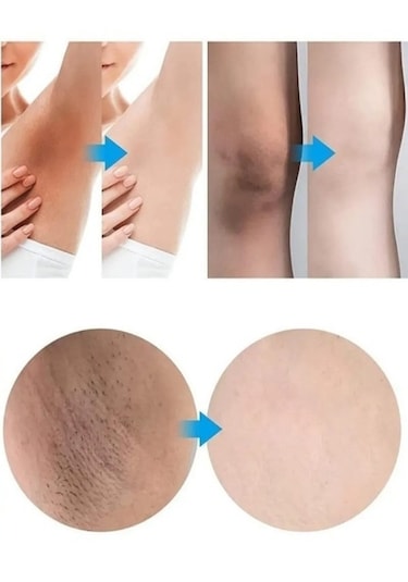 Kanza Beauty Cilt Beyazlatıcı Kem 30 G