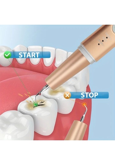 Willowhaven Golden Evde Kullanım İçin 3 Modlu 4 Metal Başlı Led Aydınlatmalı Elektrikli Diş Temizleyici Seti