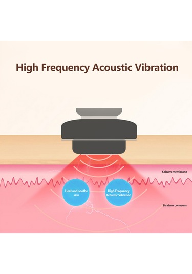 Hangfox Ev İçi El Tipi Radyo Frekanslı Cilt Bakımı Aleti - Mikroakım İçeri Aktarımı, 4 Renkli Işık Modu, 2 Seviye Güç Ayarı, Beyaz
