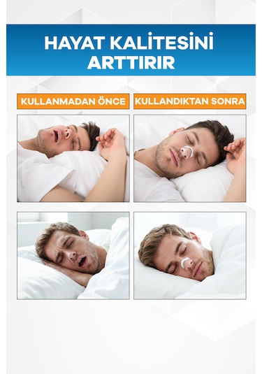 Eldi Medikal Manyetik Burun Açıcı Bandı Başlama Seti 30 Çift Beyaz