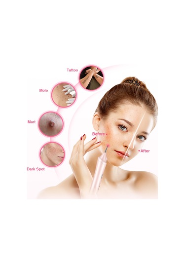 Sones K-skın Kd306 Lazer Nokta Belirleme Makinesi Plazma Kalemi Koyu Kirpik Sökücü Yüz Spazmı Giderme Dövme Cilt Bakımı Pembe
