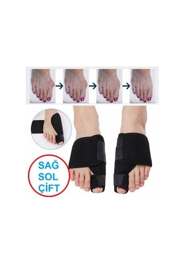 Halluks Valgus Gece Ateli Ayak Baş Parmak Kemik Çıkıntısı
