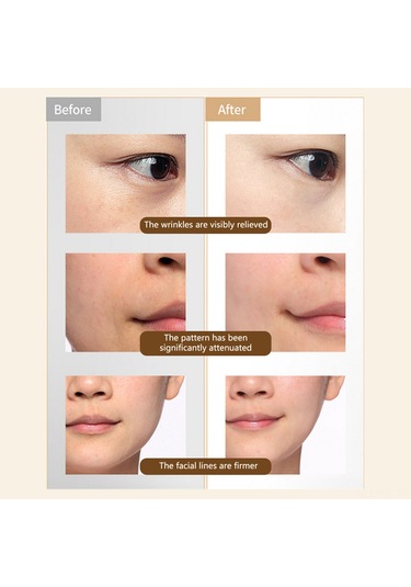 Hangfox Ev İçi El Tipi Radyo Frekanslı Cilt Bakımı Aleti - Mikroakım İçeri Aktarımı, 4 Renkli Işık Modu, 2 Seviye Güç Ayarı, Beyaz