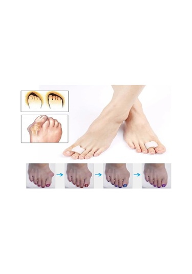 Ozclife Ayak Parmak Ayırıcı Yüzüklü Makara