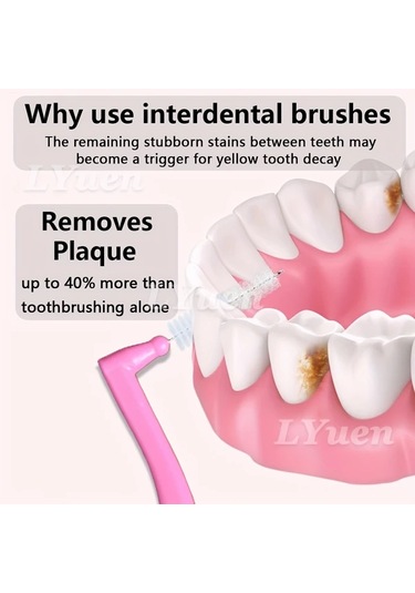 Willowhaven Yeşil 0.8mm L Tipi Diş Arası Fırçası 20'li Kutu Ağız Bakımı