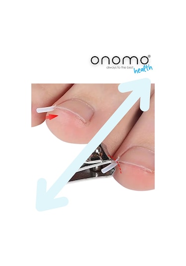 Health Batık Tırnak Düzeltici Şerit 10 Adet