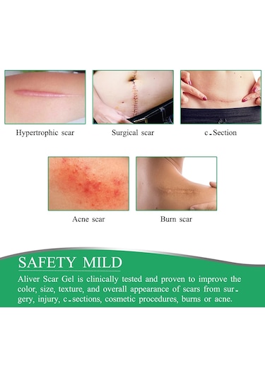 10-50 Cm Silikon Yara Izleri Yama Yara Bandı Sivilce Yanık Yara Izi Tedavisi Kapak Kulak Düzelticiler Verimli Onarım Hasarlı Cilt Levha