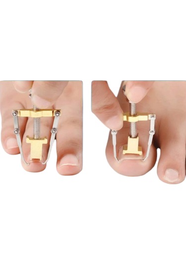 Akestoria Med Batık Tırnak Çıkarıcı Ve Düzeltici Aleti Fc-037 Standart