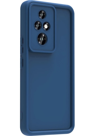 Honor 200 Pro Kılıf Kamera Korumalı Zore Ananas Kapak