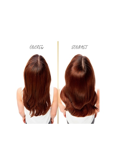 Pantene 3 in 1 Kepeğe Karşı Etkili Şampuan 2 x 400 ML