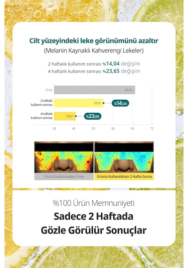 Leke Karşıtı Serum Yaprak Maske Goodal Green Tangerine Vita C Dark Spot Care Serum Sheet Mask