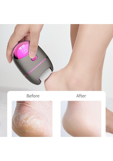 Moveevo Taşınabilir Elektronik Ayak Törpüsü Pedikür Aletleri, Profesyonel Pedi Ayak Bakımı Ölü, Sert Çatlak Kuru Ciltler İçin