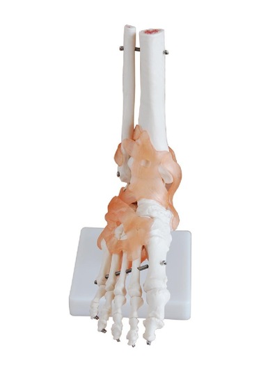 Ligamentli Ayak Eklemi Modeli