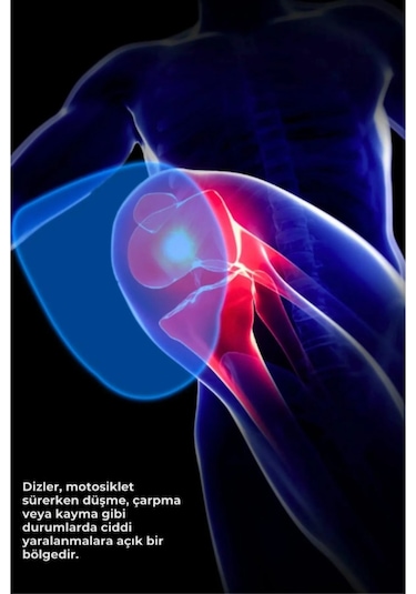 Motosiklet Lüx Dizlik Mafsallı Koruma Rahat Kullanım Motorcu Diz Koruyucu Siyah