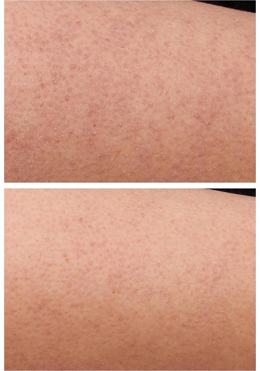 Strivectin Kp Care Texture Smoothing Vücut Kremi 200 ML