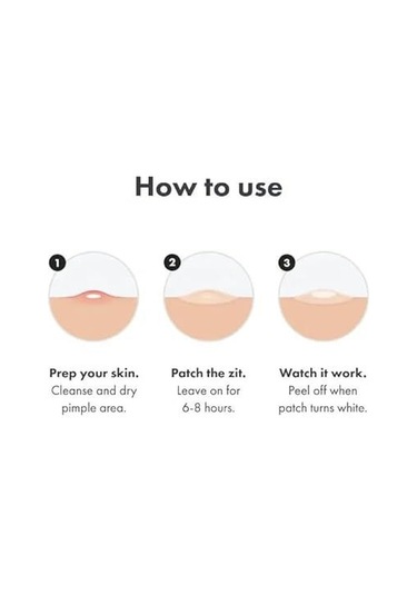 Youtek Sivilce Yama Seti - 144 Adet Hidrokolloid Yama & Çay Ağacı Yağı - Hassas Ciltler İçin Not: 113 Karakter Sınırına Uygun Olarak Optimize Edilmiştir