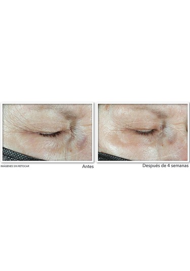 Roc Multi Correxion Hydrate Plump Göz Çevresi Kremi 15ml