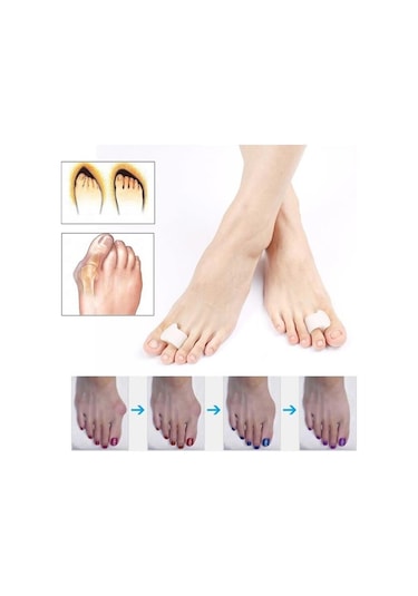 Ayak Orta Parmak Yüzük Parmak Arası Makaralı Silikon Nasır Tahriş
