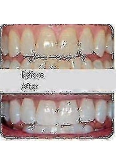 Elektrikli Diş Fırçası Yetişkinler - Ultrasonik U-şekilli Diş Fırçaları - 360 Ağız Temizleme - Kablosuz Şarj Ve Led Işık - Siyah Sertifikalı Whit Walkbee