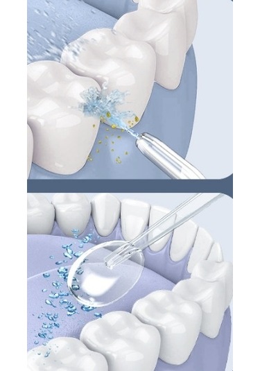 Lichen Taşınabilir Elektrikli Su Diş İpi, Ev Tipi Beyazlatma Su