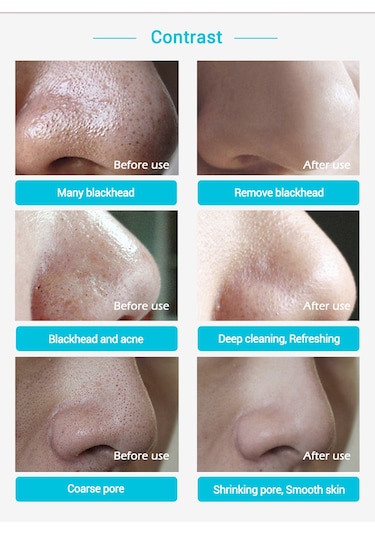 Lanbena Siyah Nokta Temizleme Maskesi 30 G