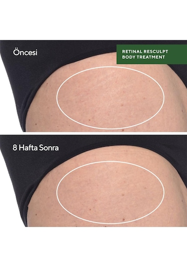 Retinal Resculpt Body Treatment - Retinal İçeren Yenileyici Vücut Bakımı 150ml