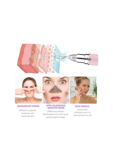 Hangfox Pink Elektrikli Siyah Nokta Ve Akne Kaldırıcı Seti - 3 Emme Seviyesi, 4 Değiştirilebilir Uç, 5 Parça Akne Aracı Pil Yok