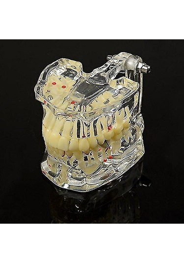 Skycity Diş Hekimi Ve Öğrencilere Özel Reçine Diş Patoloji Gösterim Modeli 1 Adet