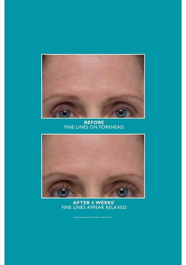 Peter Thomas Roth Peptide Skinjection Amplified Wrinkle-fix Yüz Serumu 30ml