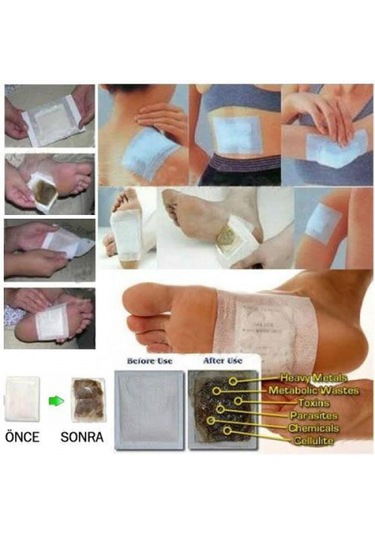 Mobgift Mobgift Detox Ayak Bandı