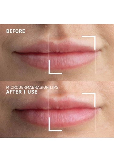 Dr. Brandt Microdermabrasion Smoothing Lip Exfoliator Dudak Peelingi