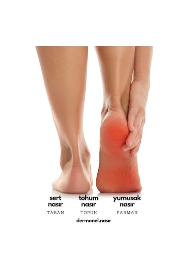 Dermanel Nasır Tedavi Seti 45 ML